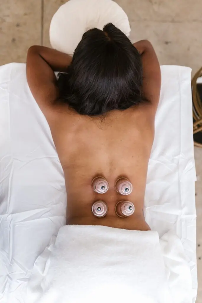 Back view of a woman receiving cupping therapy in a spa, promoting wellness and relaxation.